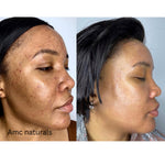 Turmeric Toner, Dark Spot Corrector, Blemish Remover, Even & Glowing Skin