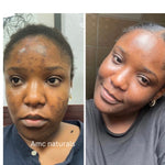 Turmeric Toner, Dark Spot Corrector, Blemish Remover, Even & Glowing Skin