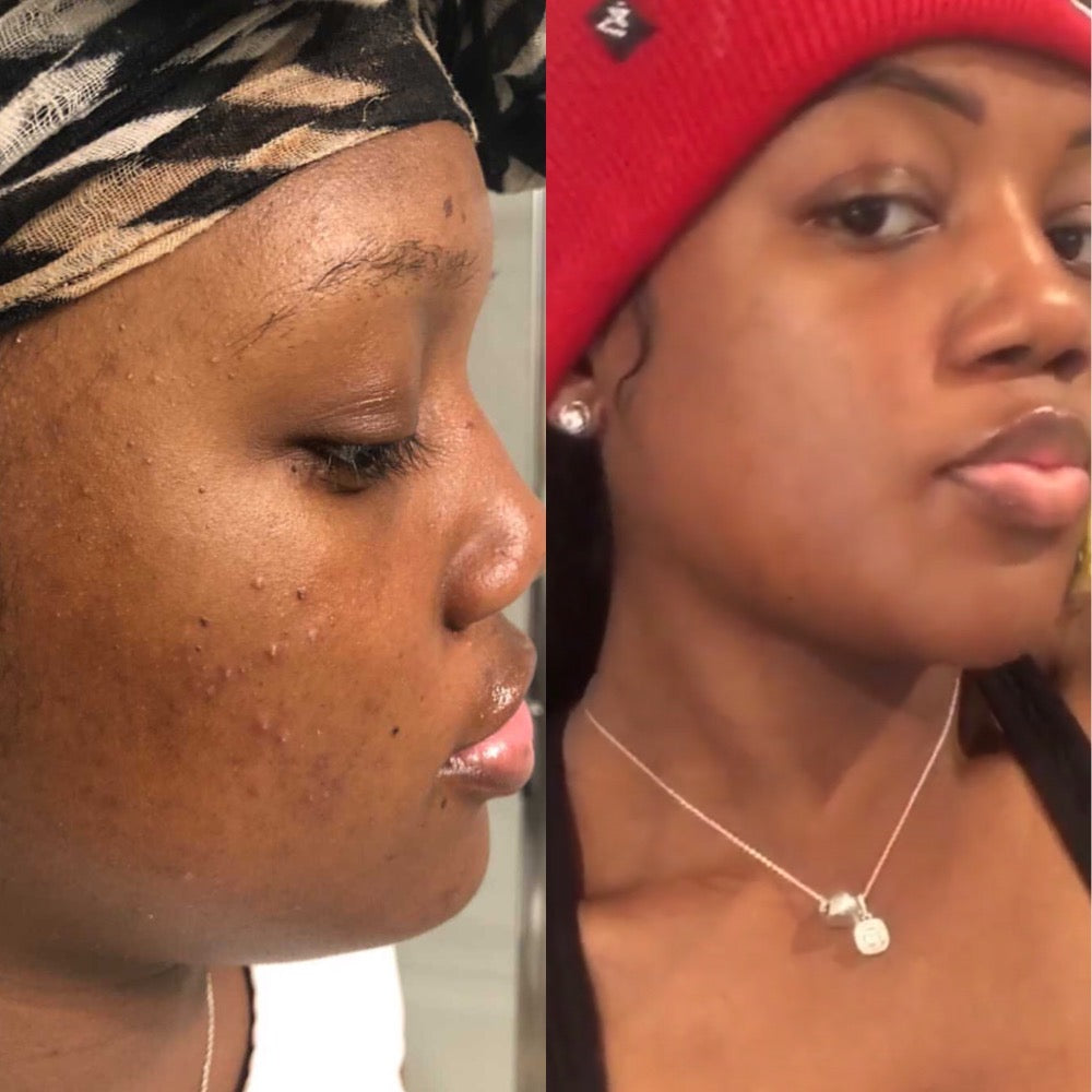 Dark Spot Correcting Serum, Collagen Brightening Facial Serum