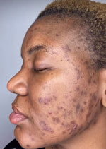 Turmeric Toner, Dark Spot Corrector, Blemish Remover, Even & Glowing Skin