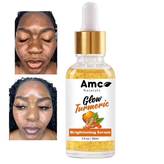 Turmeric Serum, Dark Spot Remover, Flawless Face Serum, Even Glowing Skin