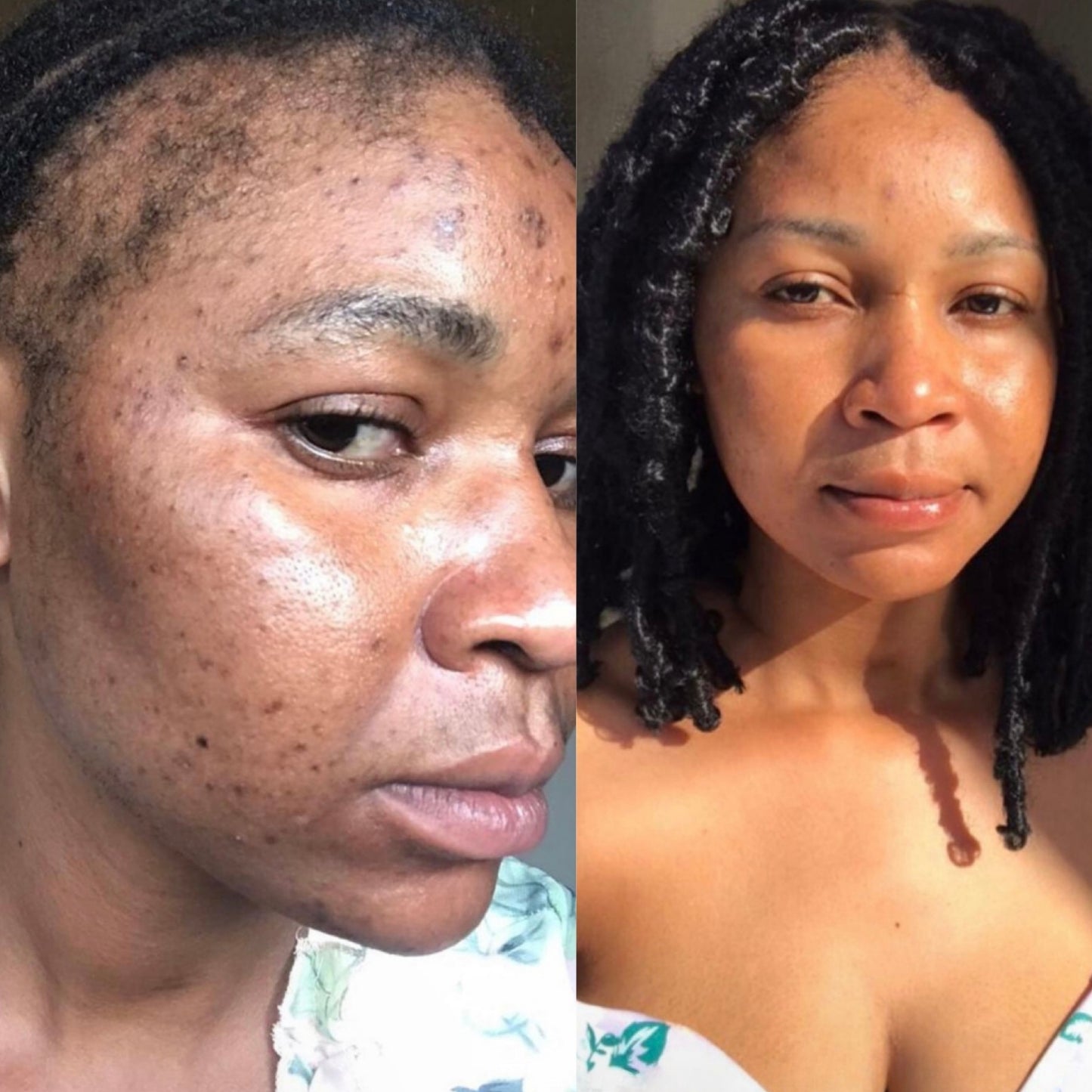 Turmeric Serum, Dark Spot Remover, Flawless Face Serum, Even Glowing Skin