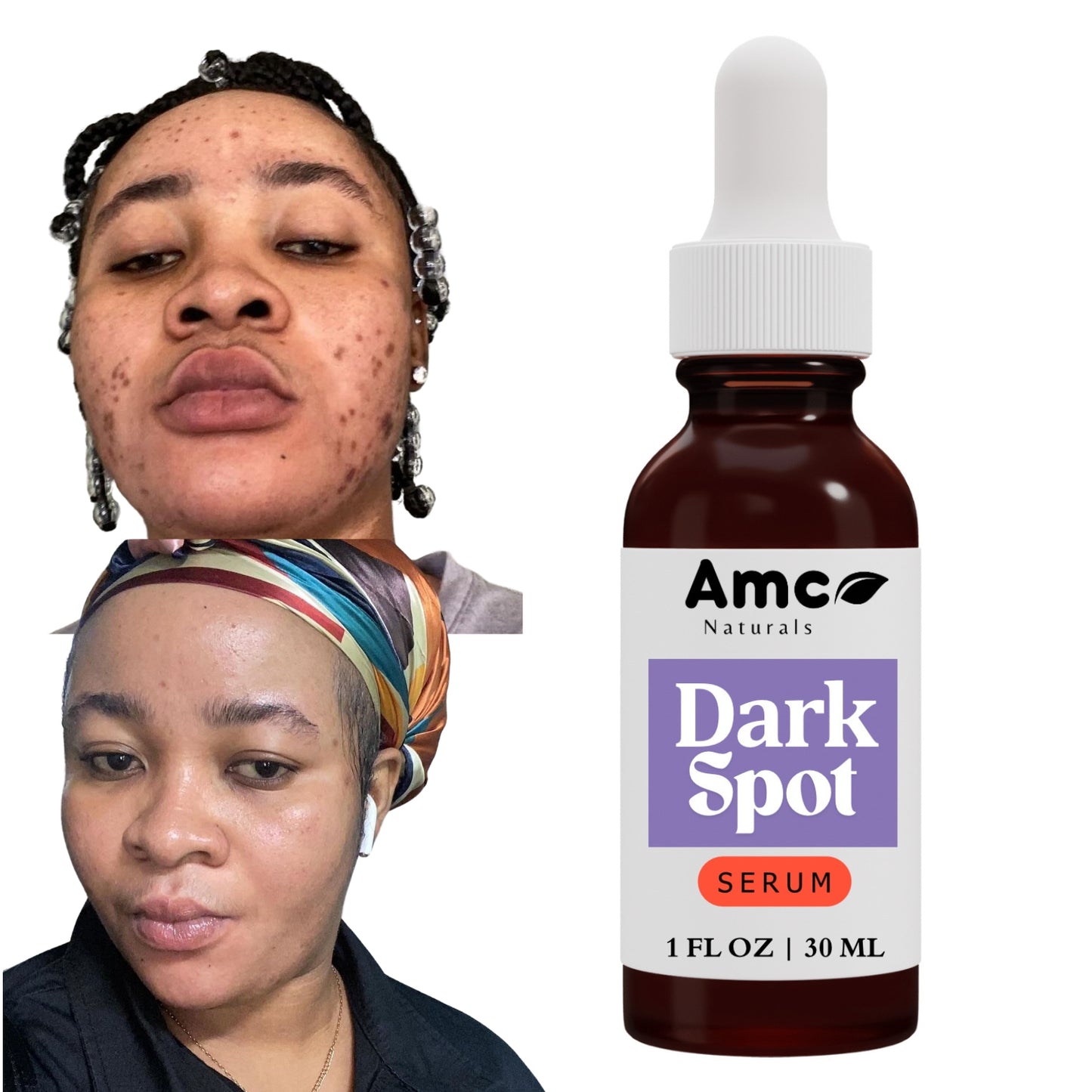 Dark Spot Correcting Serum, Collagen Brightening Facial Serum