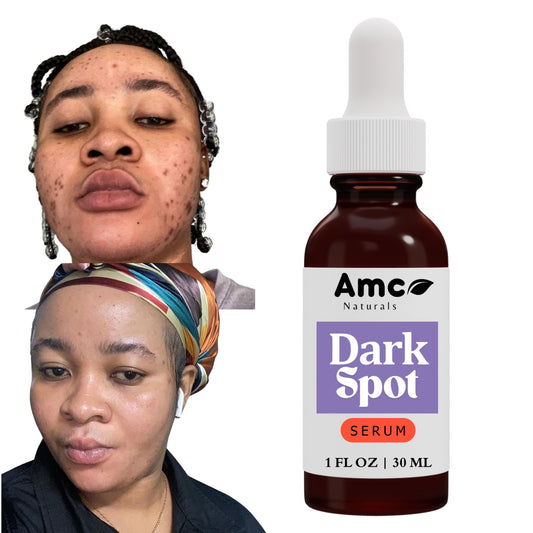 Dark Spot Correcting Serum, Collagen Brightening Facial Serum