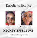 Dark Circles Serum, Under Eye Brightening Serum, Intense Dark Circle Eraser