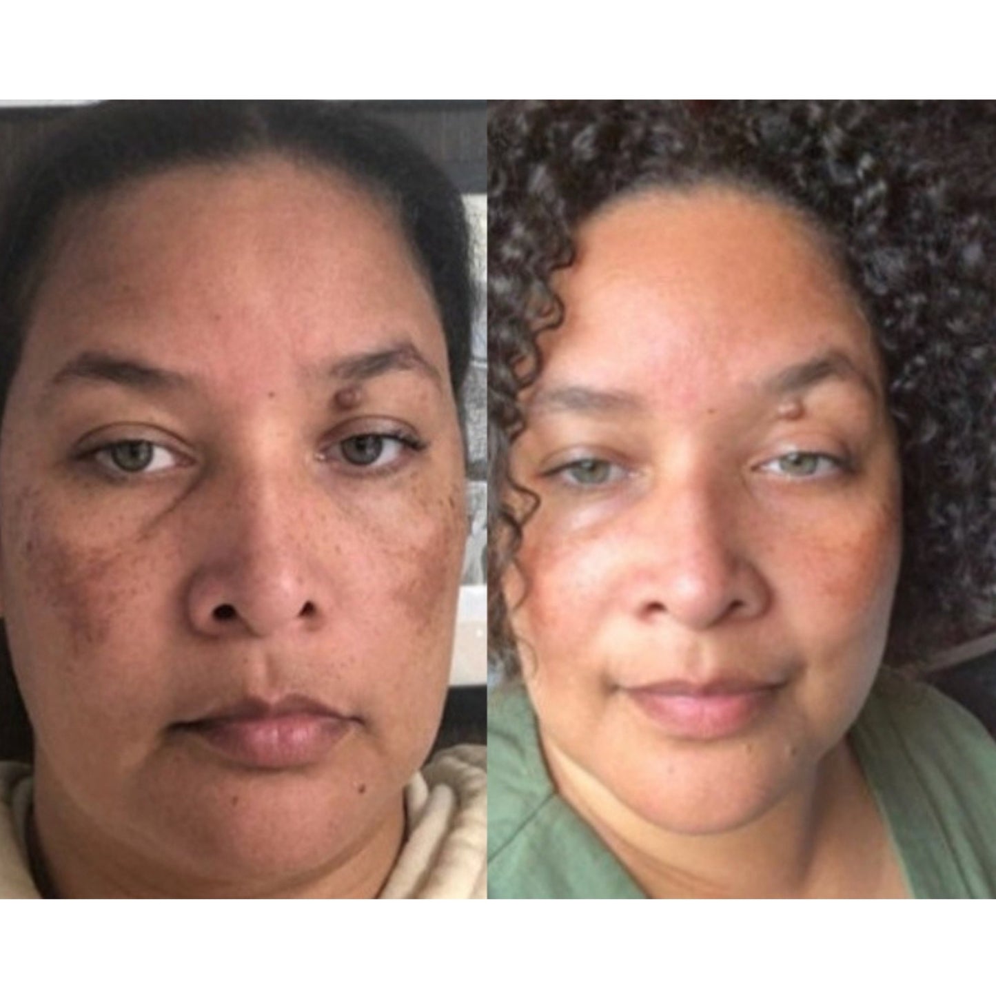 Dark Spot Correcting Serum, Collagen Brightening Facial Serum