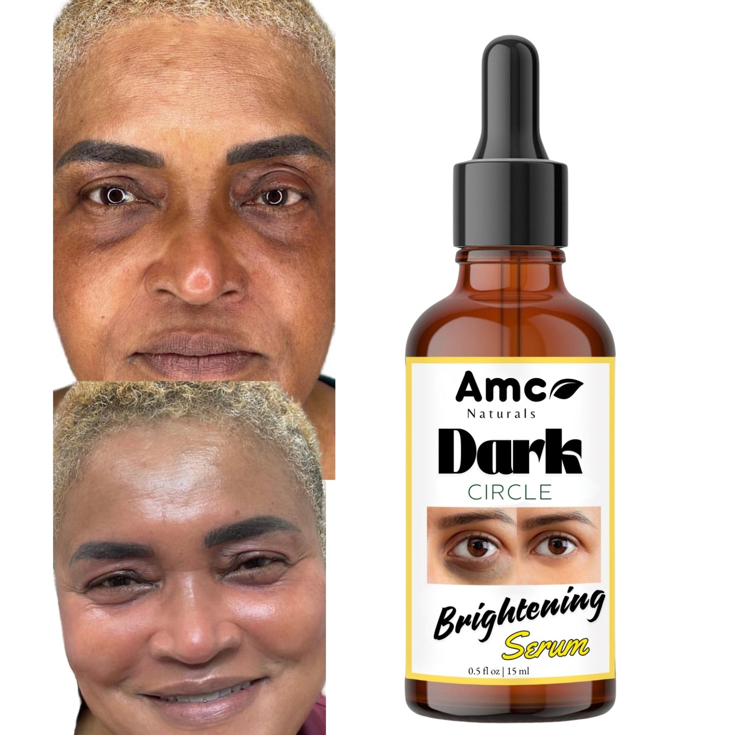 Dark Circles Serum, Under Eye Brightening Serum, Intense Dark Circle Eraser