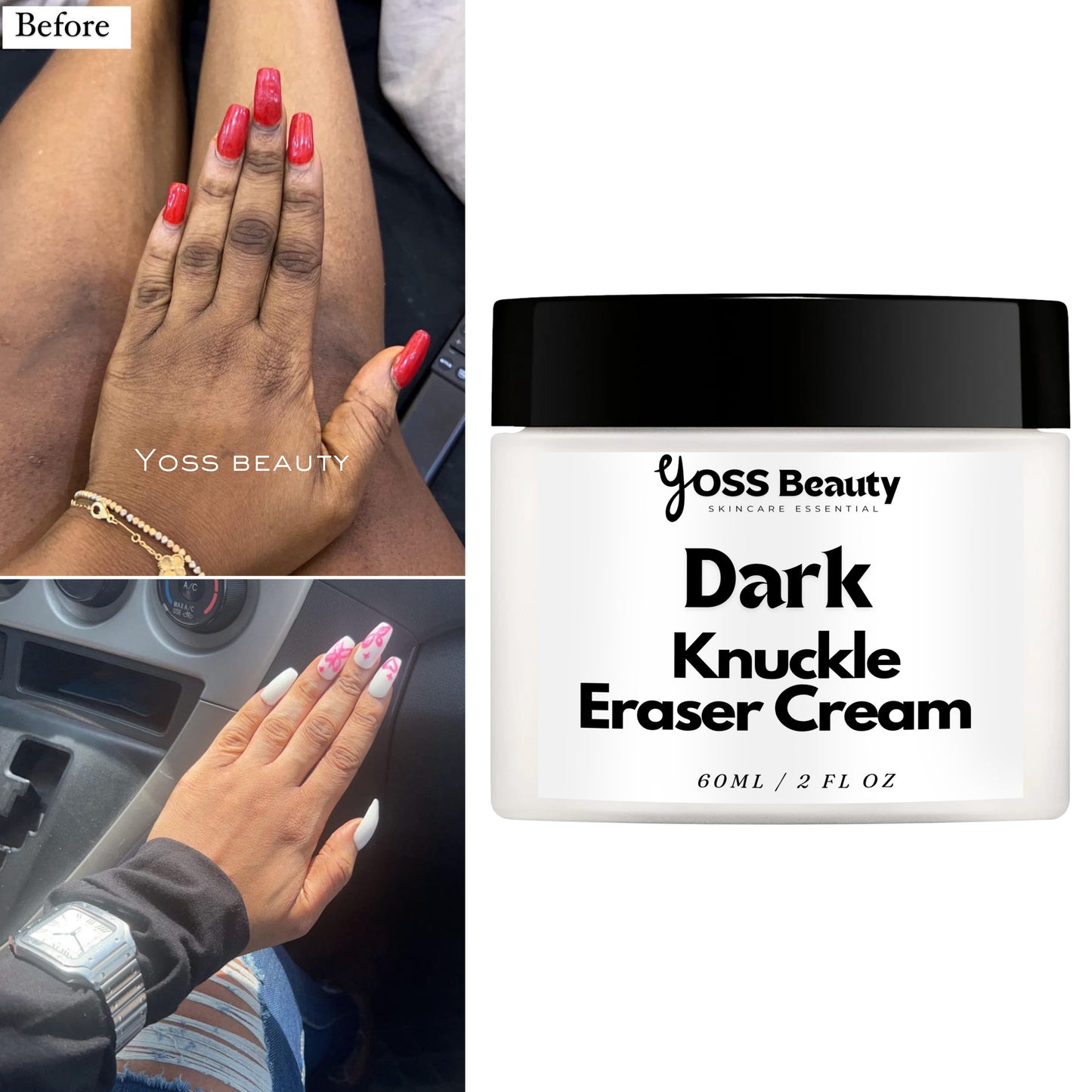 Dark Knuckle Eraser Cream, Intense Knuckle Brightening Cream