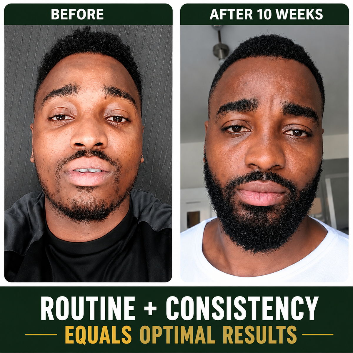 Beard Growth Oil, Rapid Beard Thickening, Plant Based Beard Growth Oil, Mean Beard Care 4oz