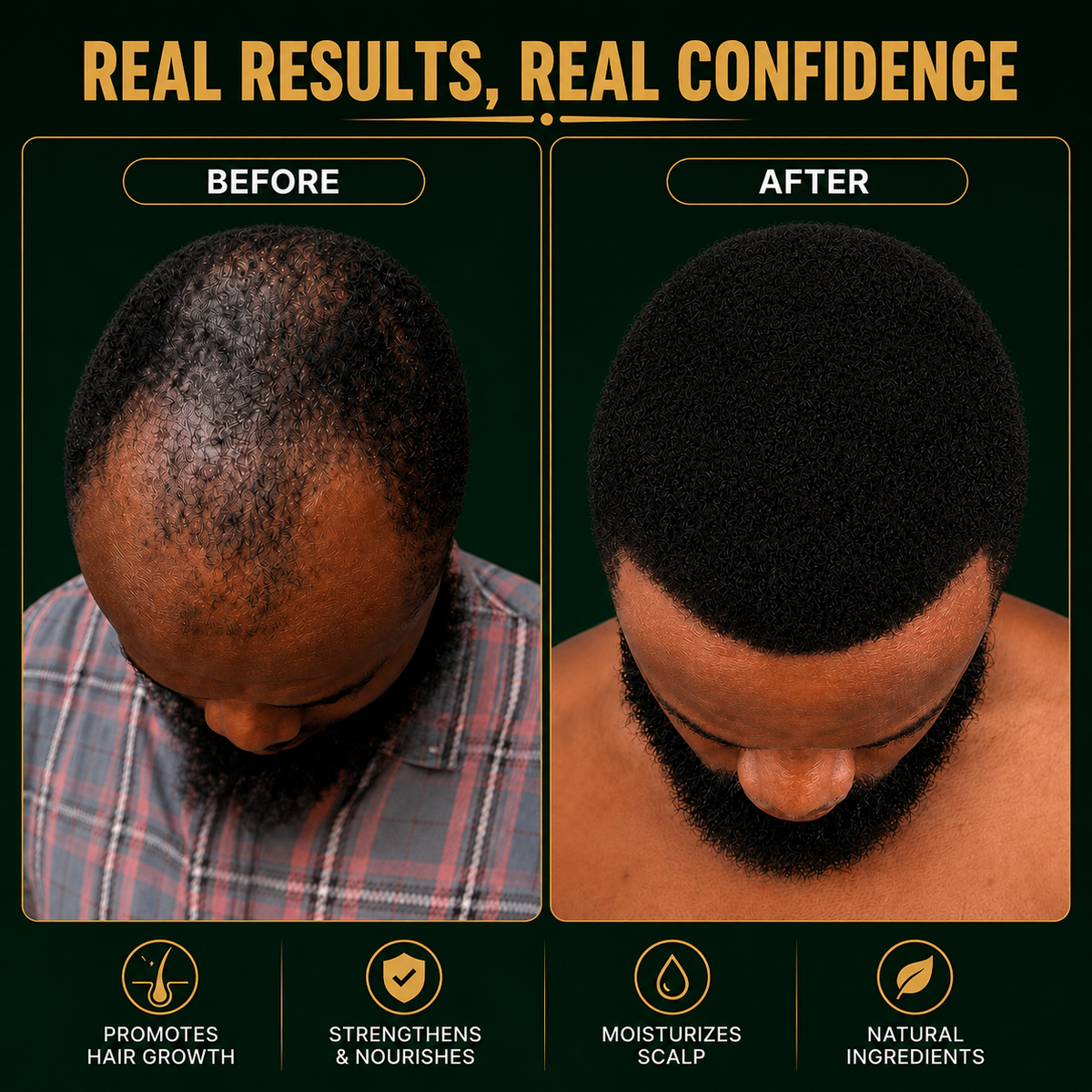 Beard Growth Oil, Rapid Beard Thickening, Plant Based Beard Growth Oil, Mean Beard Care 4oz
