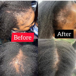 Herbal Hair Growth Oil with Rosemary & Fenugreek, Nourishing Oil for Enhanced Hair Growth and Scalp Protection 4fl oz