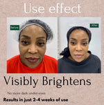 Dark Circles Serum, Under Eye Brightening Serum, Intense Dark Circle Eraser