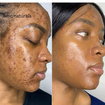 Turmeric Serum, Dark Spot Remover, Flawless Face Serum, Even Glowing Skin