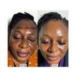 Dark Spot Correcting Serum, Collagen Brightening Facial Serum