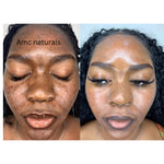 Turmeric Serum, Dark Spot Remover, Flawless Face Serum, Even Glowing Skin