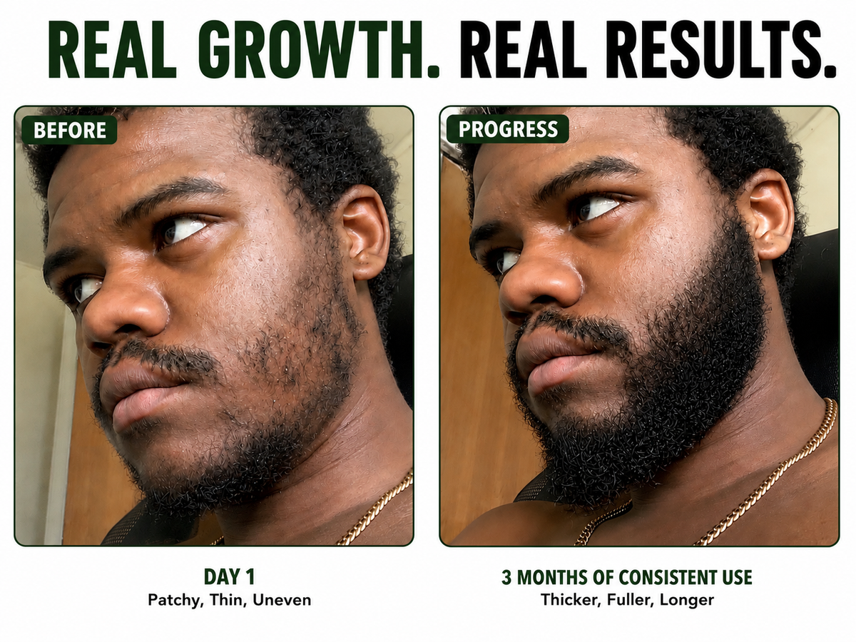 Beard Growth Oil, Rapid Beard Thickening, Plant Based Beard Growth Oil, Mean Beard Care 4oz