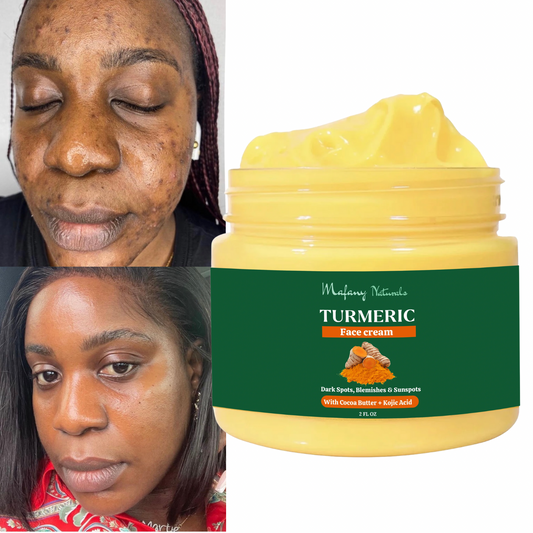 Turmeric Face Cream, Dark Spot Remover, Even, Glowing, Even Skin Tone 60ml