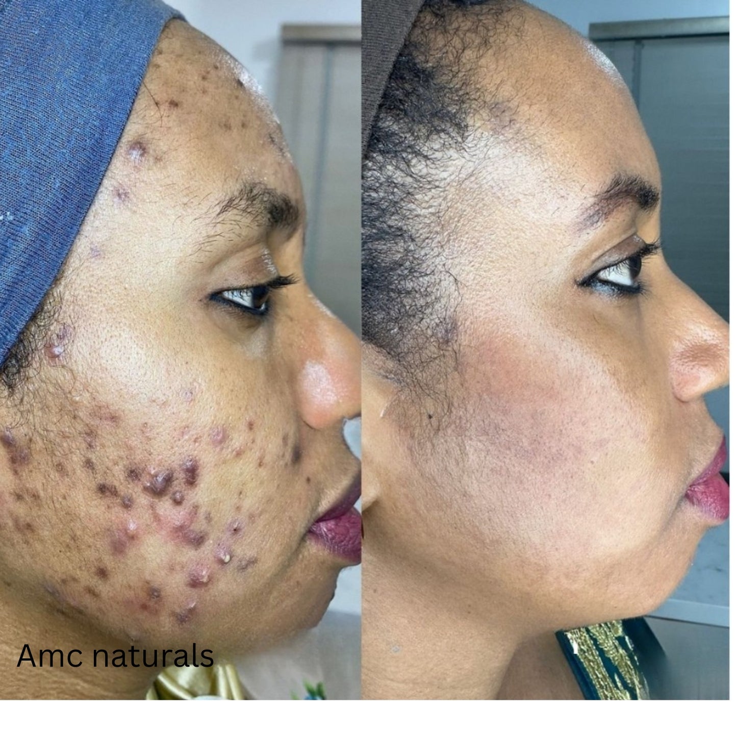 Dark Spot Correcting Serum, Collagen Brightening Facial Serum