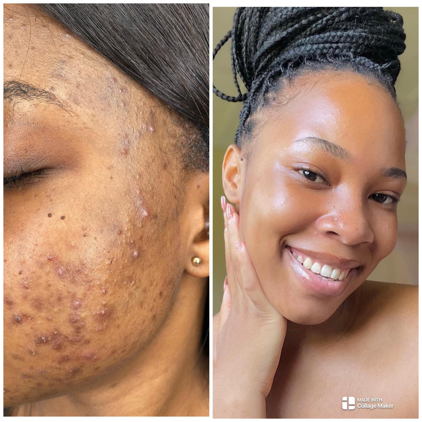 Turmeric Toner, Dark Spot Corrector, Blemish Remover, Even & Glowing Skin