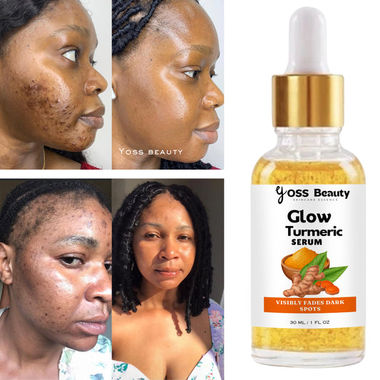 Turmeric Serum, Dark Spot Remover, Flawless Face Serum, Even Glowing Skin