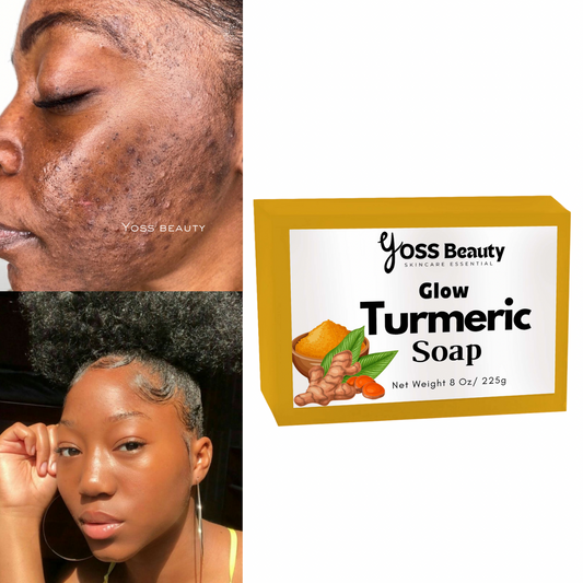 Turmeric Glow Bar Soap, Dark Spot & Blemish Removing Bar, Extra Glow Smoothing Soap