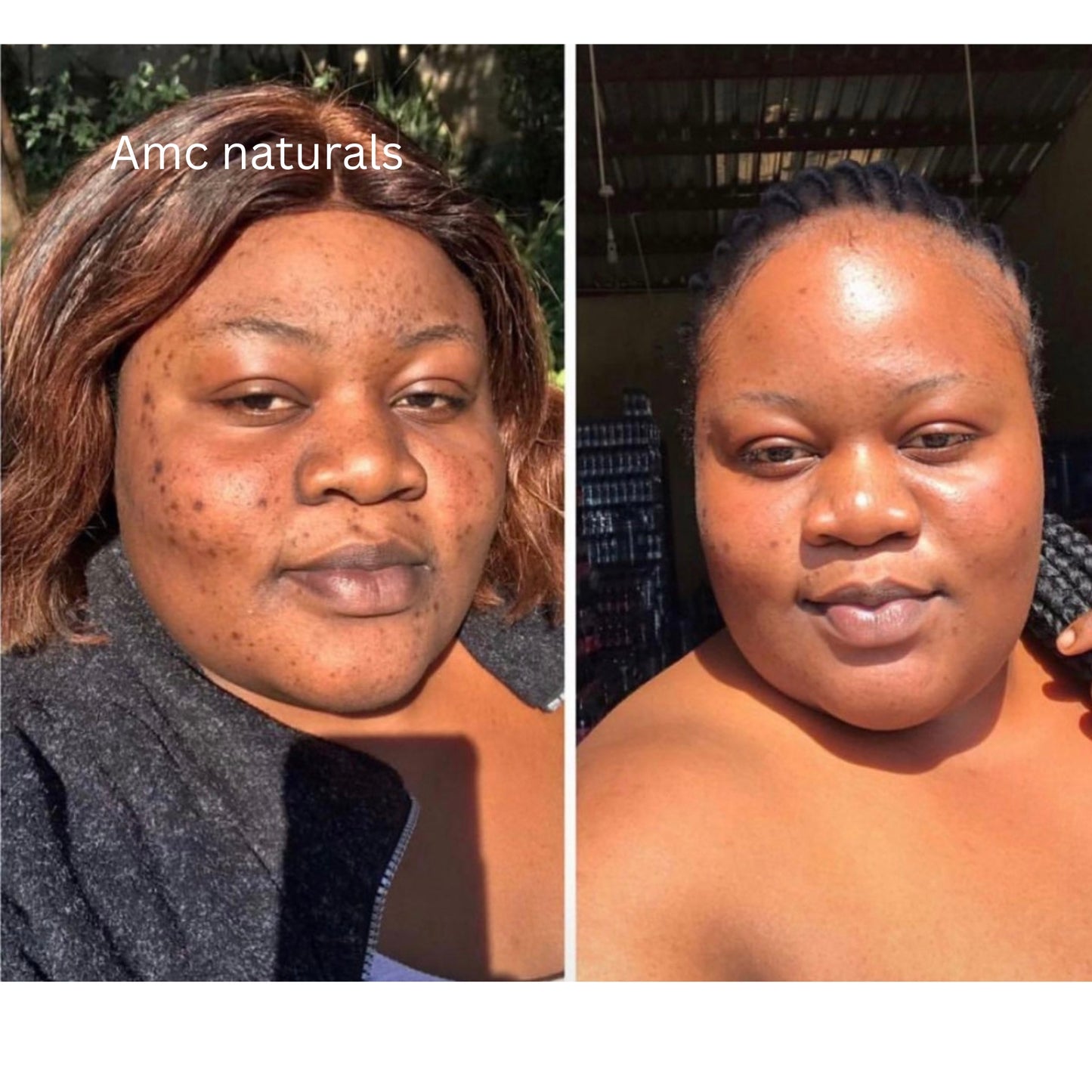 Dark Spot Correcting Serum, Collagen Brightening Facial Serum