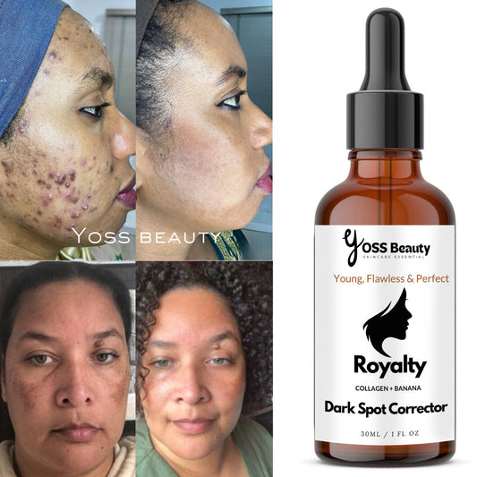 Dark Spot Correcting Serum, Collagen Brightening Facial Serum