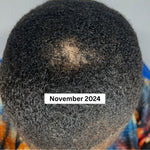 Hair Growth Oil, Longer and Thicker Hair, Herbal Infused Fast Hair Growth Oil 4oz