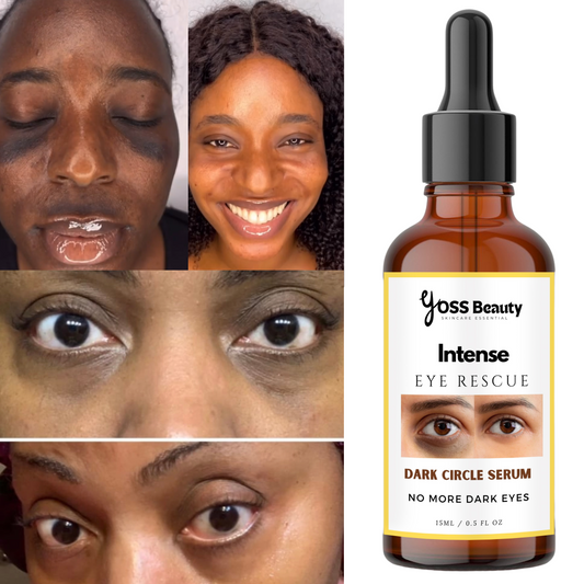 Dark Circles Remover, Under Eye Brightening Serum, Intense Dark Circle Eraser