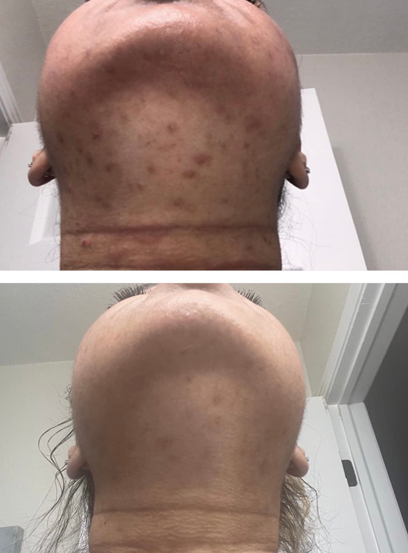 Turmeric Serum, Dark Spot Remover, Flawless Face Serum, Even Glowing Skin