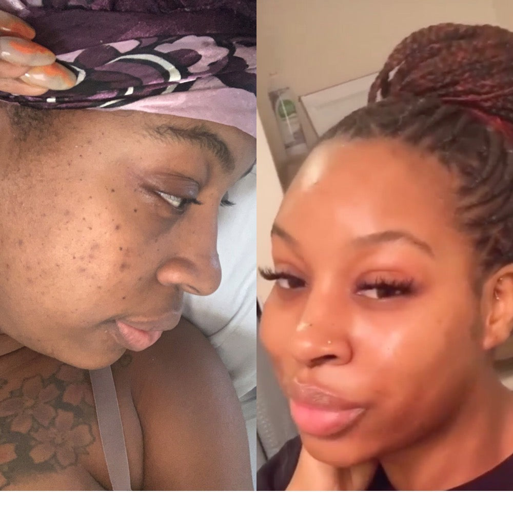 Dark Spot Correcting Serum, Collagen Brightening Facial Serum