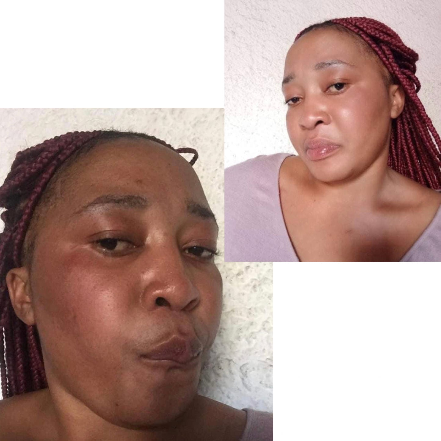 Turmeric Serum, Dark Spot Remover, Flawless Face Serum, Even Glowing Skin