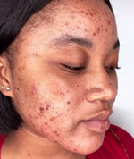 Turmeric Serum, Dark Spot Remover, Flawless Face Serum, Even Glowing Skin